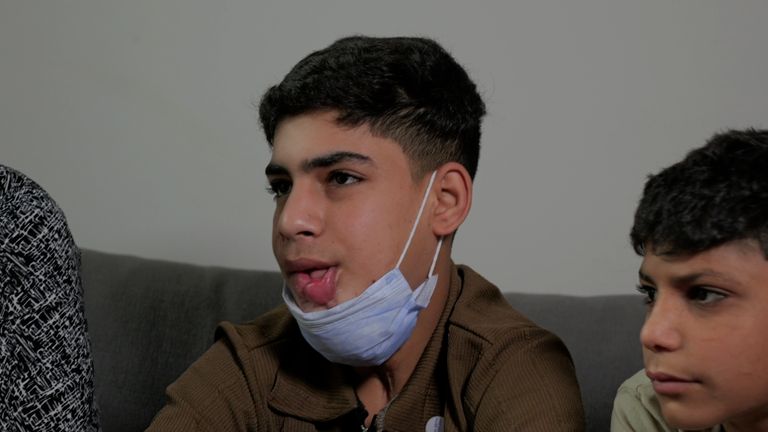 'Anda menyapa kami dengan cara yang menyenangkan' Seorang anak Gaza tiba di Inggris untuk perawatan
